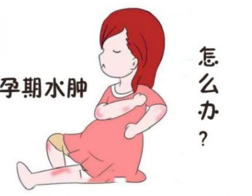 孕期为什么会水肿(孕期水肿是怎么回事) 第3张 孕期为什么会水肿(孕期水肿是怎么回事) 第3张