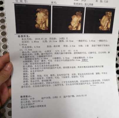 胎儿偏大有什么影响(怀孕32周检查胎儿偏大3周正常吗) 第3张 胎儿偏大有什么影响(怀孕32周检查胎儿偏大3周正常吗) 第3张