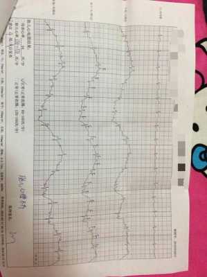怀孕多少周能做心电图，血常规啊,胎儿心电图怎么看算正常  第2张
