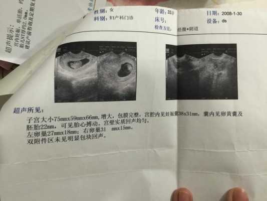 孕囊偏大跟孕期对不上(孕囊偏大跟孕期对不上求原因) 第1张 孕囊偏大跟孕期对不上(孕囊偏大跟孕期对不上求原因) 第1张