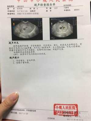 孕囊偏大跟孕期对不上(孕囊偏大跟孕期对不上求原因) 第2张 孕囊偏大跟孕期对不上(孕囊偏大跟孕期对不上求原因) 第2张
