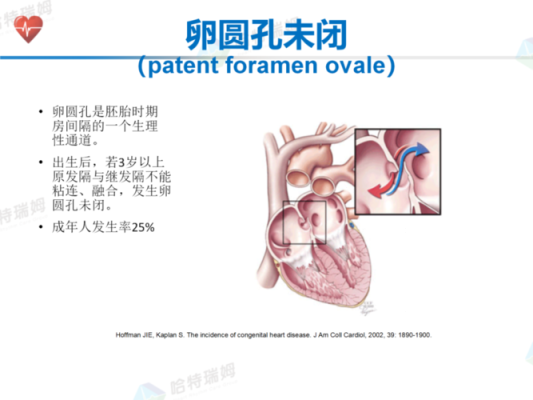 胎儿卵圆孔早闭(新生儿卵圆孔未闭怎么治疗) 第3张 胎儿卵圆孔早闭(新生儿卵圆孔未闭怎么治疗) 第3张