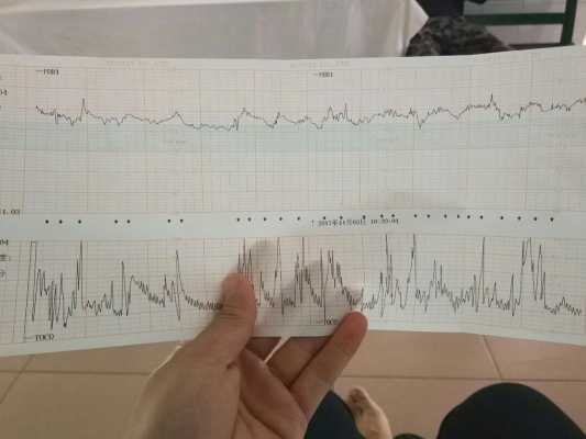 胎儿心率170正常吗(胎儿心跳达到170了怎么办) 第2张 胎儿心率170正常吗(胎儿心跳达到170了怎么办) 第2张