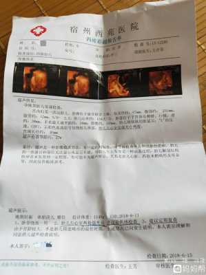 胎儿六个月四维彩超(胎儿六个月四维彩超图片) 第2张 胎儿六个月四维彩超(胎儿六个月四维彩超图片) 第2张