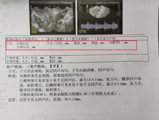 请问怀孕之后子宫会不会增大啊?子宫增大的速度超过胎龄是否不正常啊,易孕期会不会怀孕吃了药  第2张