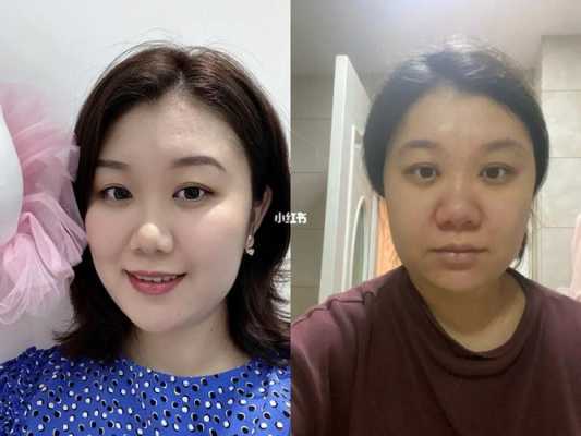 为什么怀孕鼻子会变大,孕期鼻子变大能恢复吗图片 第3张 为什么怀孕鼻子会变大,孕期鼻子变大能恢复吗图片 第3张