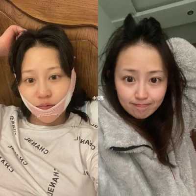 为什么怀孕鼻子会变大,孕期鼻子变大能恢复吗图片 第1张 为什么怀孕鼻子会变大,孕期鼻子变大能恢复吗图片 第1张