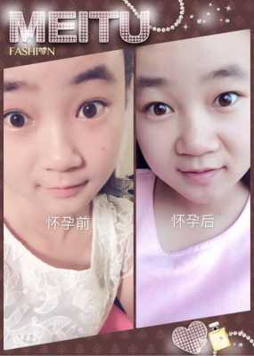 为什么怀孕鼻子会变大,孕期鼻子变大能恢复吗图片 第2张 为什么怀孕鼻子会变大,孕期鼻子变大能恢复吗图片 第2张