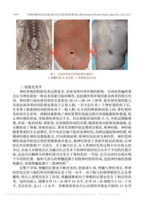 胎儿闭合性脊柱裂(脊柱裂是什么病) 第1张 胎儿闭合性脊柱裂(脊柱裂是什么病) 第1张