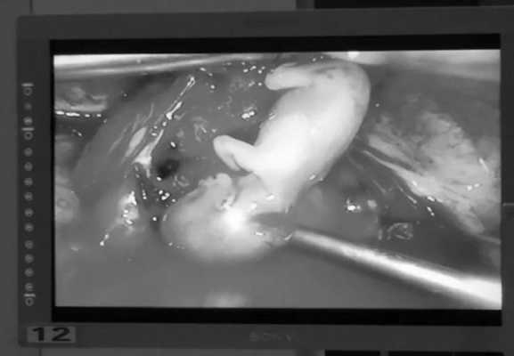 怀孕三个月的胎儿图片（怀孕三个月的胎儿图片有多大）  第2张