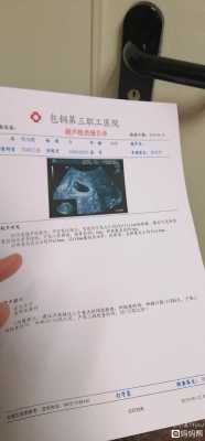十一周的胎儿有多大(孕10周和孕11周胎心都是180危险吗?应该怎么办,其他的都正常) 第2张 十一周的胎儿有多大(孕10周和孕11周胎心都是180危险吗?应该怎么办,其他的都正常) 第2张