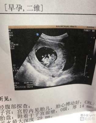 怀孕10周胎儿有多大(孕9周和孕10周的血hcg都是10万,胎儿正常吗) 第2张 怀孕10周胎儿有多大(孕9周和孕10周的血hcg都是10万,胎儿正常吗) 第2张