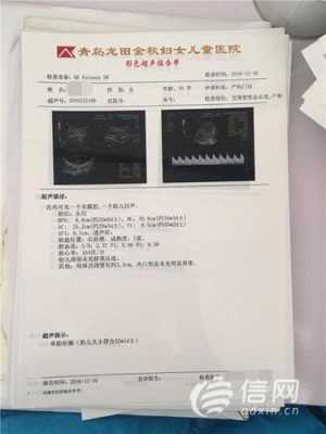 彩超隔多久可以做一次啊?一般情况下怀孕后要做几次彩超,整个孕期可以做几次b超检查 第2张 彩超隔多久可以做一次啊?一般情况下怀孕后要做几次彩超,整个孕期可以做几次b超检查 第2张