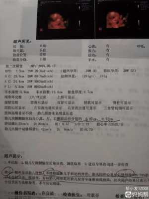 怀孕26周胎儿左侧侧脑室宽1.02正常吗,孕23周胎儿左侧侧脑室正常值 第1张 怀孕26周胎儿左侧侧脑室宽1.02正常吗,孕23周胎儿左侧侧脑室正常值 第1张