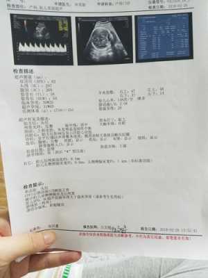 怀孕26周胎儿左侧侧脑室宽1.02正常吗,孕23周胎儿左侧侧脑室正常值 第2张 怀孕26周胎儿左侧侧脑室宽1.02正常吗,孕23周胎儿左侧侧脑室正常值 第2张