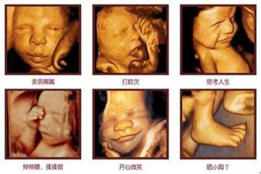 做彩超对胎儿有影响吗?怀孕六个多月了，这个检查对宝宝有辐射吗,孕妇照对胎儿有影响不  第1张