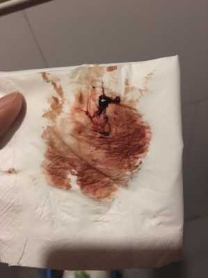 怀孕两周会出血吗?怀孕早期女性身体会有什么症状,出血又不像来月经怎么回事 第2张 怀孕两周会出血吗?怀孕早期女性身体会有什么症状,出血又不像来月经怎么回事 第2张