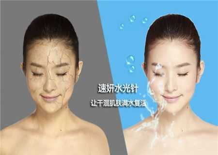 备孕期可以打水光针吗（备孕期可以打水光针吗女性）  第1张