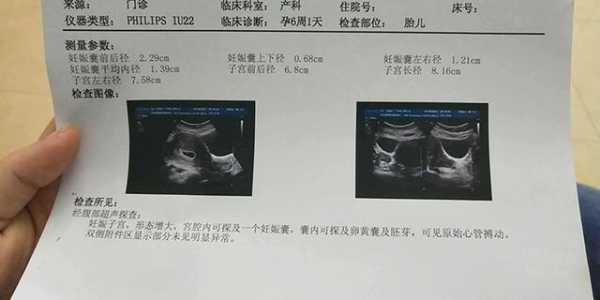 胎儿多长时间有胎心(胎儿多长时间有胎心胎芽) 第1张 胎儿多长时间有胎心(胎儿多长时间有胎心胎芽) 第1张