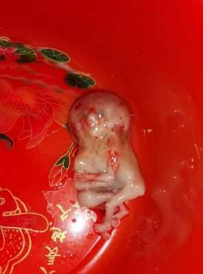 胚胎停育有什么症状,孕早期胎儿停育有什么症状 第1张 胚胎停育有什么症状,孕早期胎儿停育有什么症状 第1张