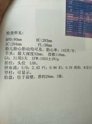 efw计算公式,efw是胎儿的什么意思 第1张 efw计算公式,efw是胎儿的什么意思 第1张