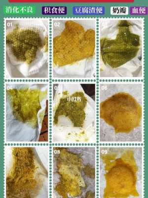 胎儿成形是几个月(宝宝什么时候拉成型的便便) 第2张 胎儿成形是几个月(宝宝什么时候拉成型的便便) 第2张