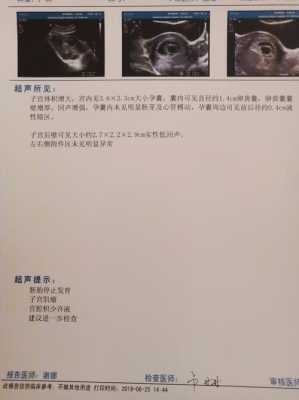 胎儿为什么会没有胎心(胎儿为什么会没有胎心胎芽) 第3张 胎儿为什么会没有胎心(胎儿为什么会没有胎心胎芽) 第3张