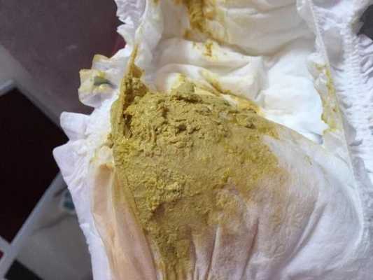 6个月宝宝大便有奶瓣是怎么回事?有奶瓣该怎么缓解,6个月的胎儿有多重,身长多少 第3张 6个月宝宝大便有奶瓣是怎么回事?有奶瓣该怎么缓解,6个月的胎儿有多重,身长多少 第3张