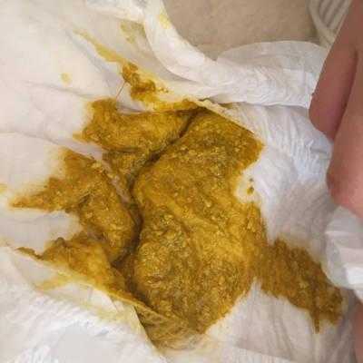6个月宝宝大便有奶瓣是怎么回事?有奶瓣该怎么缓解,6个月的胎儿有多重,身长多少 第2张 6个月宝宝大便有奶瓣是怎么回事?有奶瓣该怎么缓解,6个月的胎儿有多重,身长多少 第2张