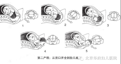 胎儿娩出的七个步骤（胎儿娩出的七个步骤衔接）  第1张