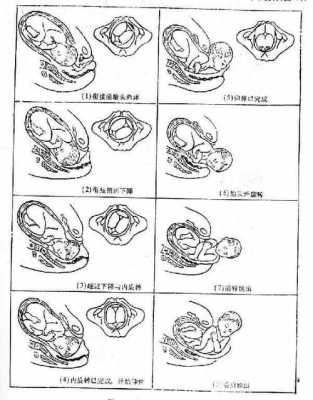 胎儿娩出的七个步骤（胎儿娩出的七个步骤衔接）  第2张