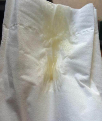 漏羊水的症状是什么啊,羊水破了最多能撑几小时 第2张 漏羊水的症状是什么啊,羊水破了最多能撑几小时 第2张