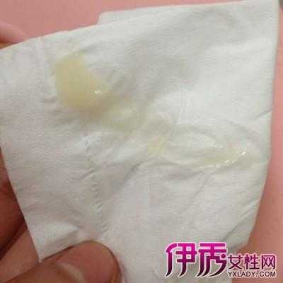怀孕后白带会增多吗, 第3张 怀孕后白带会增多吗, 第3张