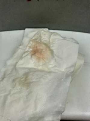 怀孕初期小便后纸上血怎么回事,怀孕期间小便出血怎么回事儿 第1张 怀孕初期小便后纸上血怎么回事,怀孕期间小便出血怎么回事儿 第1张