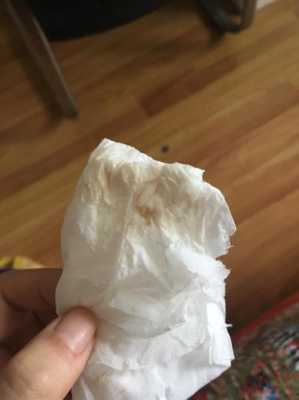怀孕初期小便后纸上血怎么回事,怀孕期间小便出血怎么回事儿 第2张 怀孕初期小便后纸上血怎么回事,怀孕期间小便出血怎么回事儿 第2张