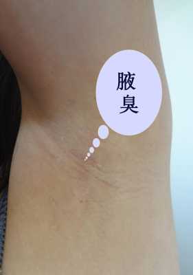 狐臭怀孕期间怎么办呢(狐臭怀孕期间怎么办呢) 第1张 狐臭怀孕期间怎么办呢(狐臭怀孕期间怎么办呢) 第1张