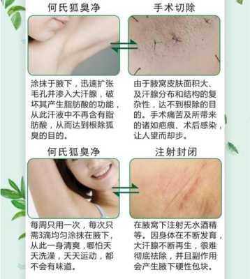 狐臭怀孕期间怎么办呢(狐臭怀孕期间怎么办呢) 第2张 狐臭怀孕期间怎么办呢(狐臭怀孕期间怎么办呢) 第2张