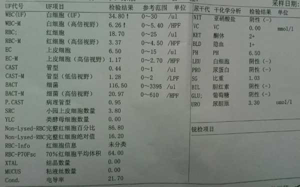 孕妇尿检白细胞高是什么原因,孕期尿常规白细胞高是什么原因要紧吗 第1张 孕妇尿检白细胞高是什么原因,孕期尿常规白细胞高是什么原因要紧吗 第1张