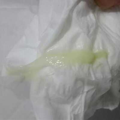怀孕期间分泌物黄绿色(怀孕期间分泌物黄绿色对胎儿影响) 第1张 怀孕期间分泌物黄绿色(怀孕期间分泌物黄绿色对胎儿影响) 第1张