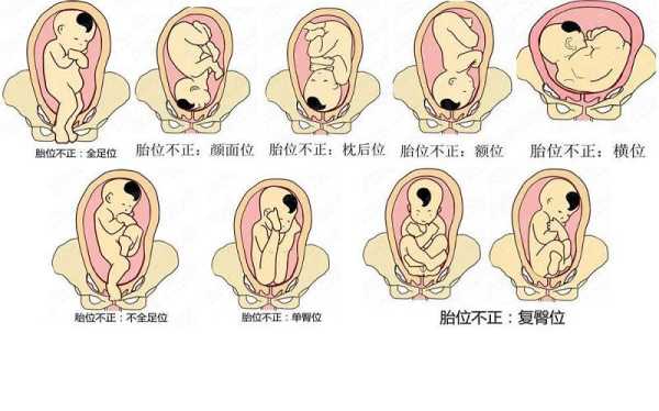 左骶前位胎儿图片（胎位左骶前是什么位置）  第2张