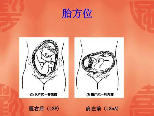 左骶前位胎儿图片(胎位左骶前是什么位置) 第1张 左骶前位胎儿图片(胎位左骶前是什么位置) 第1张