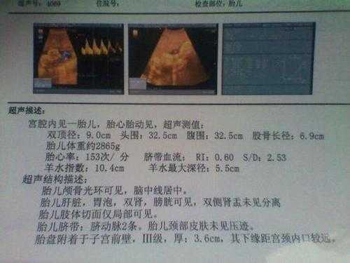 四维B超单上写着胎儿生物物理相评分8分是什么意思,胎儿8个月四维彩超图  第2张