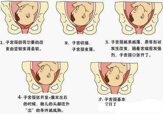 怀孕后胎儿入盆有什么症状,怎么知道胎儿是否入盆了  第3张
