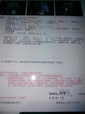 胎儿心脏有两个点是怎么回事,胎儿超声心动图是什么检查 第1张 胎儿心脏有两个点是怎么回事,胎儿超声心动图是什么检查 第1张