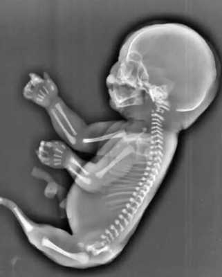 胎儿有尾巴的图片（胎儿有尾巴的图片真实）  第2张