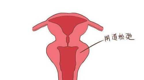 孕期阴道  第2张
