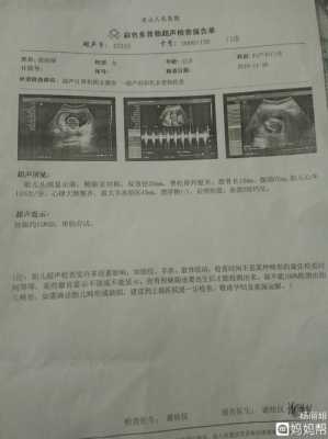 孕十一周胎儿发育情况(孕11周胎心率177正常吗) 第2张 孕十一周胎儿发育情况(孕11周胎心率177正常吗) 第2张