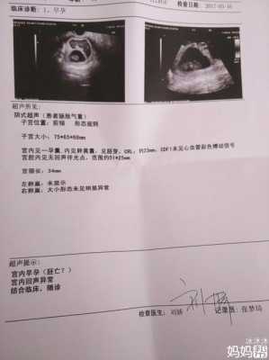 50天胎心不稳定咋回事,胎心不稳对胎儿的影响有哪些 第1张 50天胎心不稳定咋回事,胎心不稳对胎儿的影响有哪些 第1张