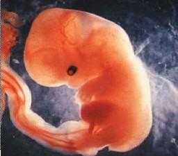 怀孕九周妈妈及胎儿变化有哪些,怀孕9周胎儿图片欣赏 真实  第2张