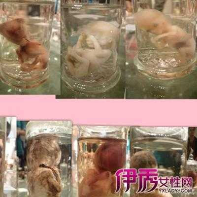 四个月引产的胎儿图片（四个月怀孕引产下来的婴儿形状能分辨出男女吗）  第2张
